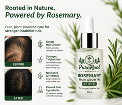 Rosemary Hair Growth Serum